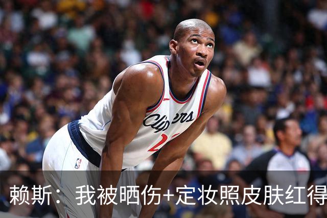 赖斯：我被晒伤+定妆照皮肤红得发亮，我妈快把我骂死了